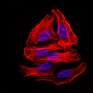 Immunofluorescence of HepG2 cells. Blue: DRAQ5 fluorescent DNA dye. Red: Actin filaments have been labeled with Alexa Fluor-555 phalloidin.