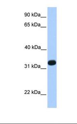 Fetal liver lysate. Antibody concentration: 1.0 ug/ml. Gel concentration: 12%.
