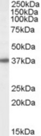 Antibody (1 ug/ml) staining of Human Liver lysate (35 ug protein in RIPA buffer). Primary incubation was 1 hour. Detected by chemiluminescence.