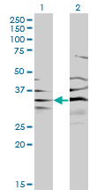 Western blot of BPNT1 expression in transfected 293T cell line by BPNT1 monoclonal antibody (M01), clone 2E1.