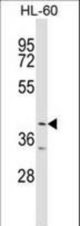 ABTB1 Antibody western blot of HL-60 cell line lysates (35 ug/lane). The ABTB1 antibody detected the ABTB1 protein (arrow).