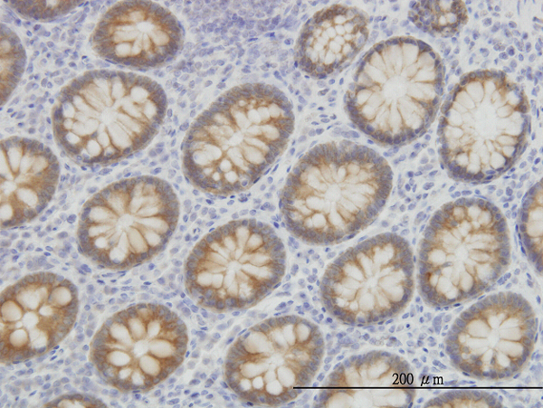Immunoperoxidase of monoclonal antibody to ACSL5 on formalin-fixed paraffin-embedded human colon. [antibody concentration 3 ug/ml]