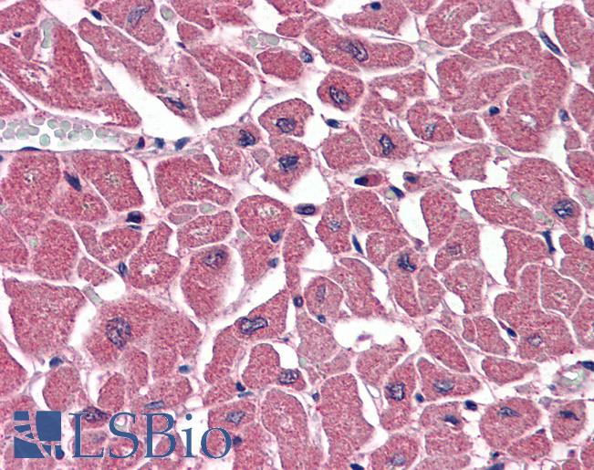Anti-ABTB1 / BPOZ antibody IHC of human heart. Immunohistochemistry of formalin-fixed, paraffin-embedded tissue after heat-induced antigen retrieval. Antibody LS-B3228 concentration 75 ug/ml.