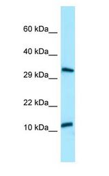 BPY2 antibody Western Blot of HepG2.