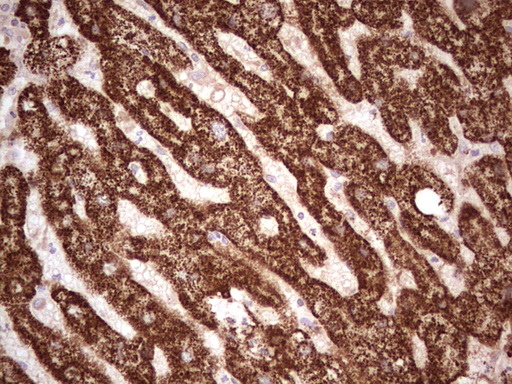 IHC of paraffin-embedded Human liver tissue using anti-ABAT mouse monoclonal antibody. (Heat-induced epitope retrieval by 1 mM EDTA in 10mM Tris, pH8.5, 120°C for 3min).
