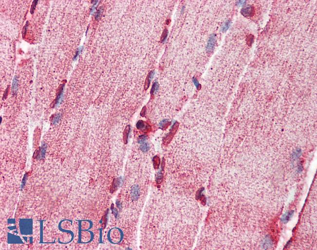 Anti-ACSL5 antibody IHC of human skeletal muscle. Immunohistochemistry of formalin-fixed, paraffin-embedded tissue after heat-induced antigen retrieval. Antibody LS-B5798 concentration 5 ug/ml.