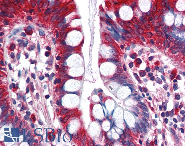 Anti-ACSL5 antibody IHC of human small intestine. Immunohistochemistry of formalin-fixed, paraffin-embedded tissue after heat-induced antigen retrieval. Antibody LS-B2761 concentration 5 ug/ml.
