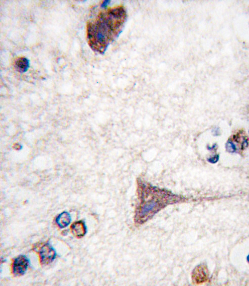 Formalin-fixed and paraffin-embedded human brain tissue reacted with BRAF-pT400, which was peroxidase-conjugated to the secondary antibody, followed by DAB staining. This data demonstrates the use of this antibody for immunohistochemistry; clinical relevance has not been evaluated.