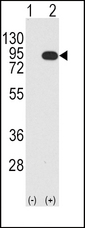 Western blot of BRAF (arrow) using rabbit polyclonal BRAF Antibody (T400) (RB13721). 293 cell lysates (2 ug/lane) either nontransfected (Lane 1) or transiently transfected with the BRAF gene (Lane 2) (Origene Technologies).