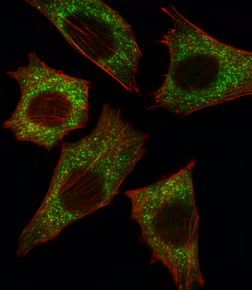 Fluorescent image of C2C12 cell stained with BRAF Antibody. C2C12 cells were fixed with 4% PFA (20 min), permeabilized with Triton X-100 (0.1%, 10 min), then incubated with BRAF primary antibody (1:25, 1 h at 37°C). For secondary antibody, Alexa Fluor 488 conjugated donkey anti-rabbit antibody (green) was used (1:400, 50 min at 37°C). Cytoplasmic actin was counterstained with Alexa Fluor 555 (red) conjugated Phalloidin (7units/ml, 1 h at 37°C). BRAF immunoreactivity is localized to Cytoplasm significantly.