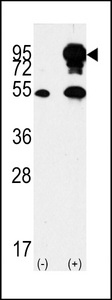 Western blot of BRAF Antibody polyclonal antibody(arrow). 293 cell lysates (2 ug/lane) either nontransfected (Lane 1) or transiently transfected with the BRAF gene (Lane 2) (Origene Technologies).