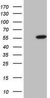 HEK293T cells were transfected with the pCMV6-ENTRY control (Left lane) or pCMV6-ENTRY ABAT (Right lane) cDNA for 48 hrs and lysed. Equivalent amounts of cell lysates (5 ug per lane) were separated by SDS-PAGE and immunoblotted with anti-ABAT.