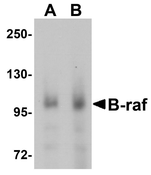Western blot analysis of B-raf in human brain tissue lysate with B-raf antibody at (A) 1 and (B) 2 ug/ml.