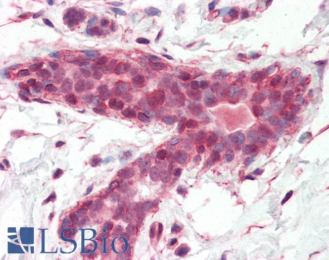 Anti-BRAP antibody IHC of human breast. Immunohistochemistry of formalin-fixed, paraffin-embedded tissue after heat-induced antigen retrieval. Antibody LS-B3402 concentration 10 ug/ml.