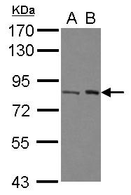 Sample (30 ug of whole cell lysate) A: A431 B: Jurkat 7.5% SDS PAGE BRAT1 / BAAT1 antibody diluted at 1:1000