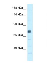 BRCA1 antibody LS-C134907 Western blot of HepG2 Cell lysate. Antibody concentration 1 ug/ml.