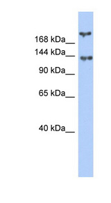 BRCA1 antibody LS-C109777 Western blot of Fetal Small Intestine lysate.