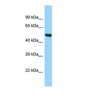 Western blot of Human HT1080. ACSBG1 antibody dilution 1.0 ug/ml.