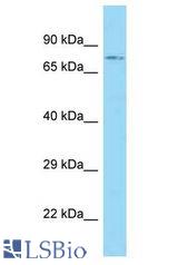 ACSBG1 / hsBG antibody Western Blot of HT1080. Antibody dilution: 1 ug/ml.