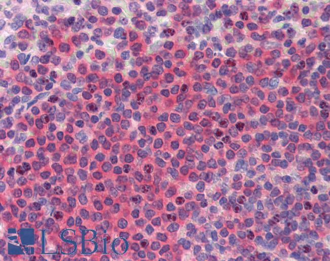 Anti-BRCC3 / BRCC36 antibody IHC of human spleen. Immunohistochemistry of formalin-fixed, paraffin-embedded tissue after heat-induced antigen retrieval. Antibody LS-B3588 concentration 5 ug/ml.