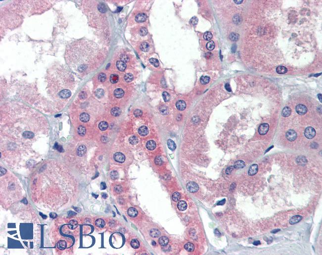 Anti-BRCC3 / BRCC36 antibody IHC of human kidney. Immunohistochemistry of formalin-fixed, paraffin-embedded tissue after heat-induced antigen retrieval. Antibody LS-B3588 concentration 5 ug/ml.