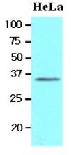 Western analysis of HeLa cell lysates.