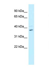 BRCC3 / BRCC36 antibody LS-C145876 Western blot of Fetal Heart lysate. Antibody concentration 1 ug/ml.