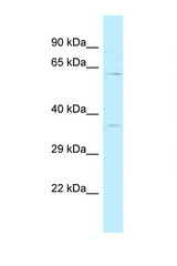 BRCC3 / BRCC36 antibody LS-C145877 Western blot of 435S Cell lysate. Antibody concentration 1 ug/ml.