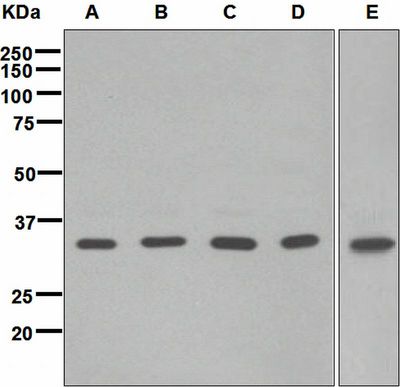 Western blot analysis on (A) MCF-7, (B) SKBR-3, (C) 293T, (D) fetal kidney, and (E) HeLa cell lysates using anti-BRCC36 antibody.