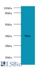 Western blot of Lys-63-specific deubiquitinase BRCC36 antibody at 2 ug/ml with HeLa whole cell lysate. Secondary: Goat polyclonal to Rabbit IgG at 1:15000 dilution. Predicted band size: 36 KDa. Observed band size: 36 KDa.