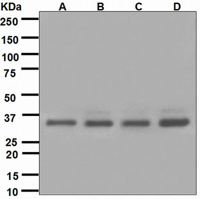 Western blot analysis on (A) HeLa, (B) MCF-7, (C) SKBR-3, and (D) 293T cell lysates using anti-BRCC36 antibody.