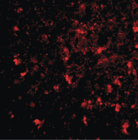 Immunofluorescence of BRCC45 in human brain tissue with BRCC45 antibody at 20 ug/ml.