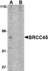 Western blot of TRIM25 in HeLa cell lysate in (A) the absence and (B) absence of blocking peptide with TRIM25 antibody at 1 ug/ml.