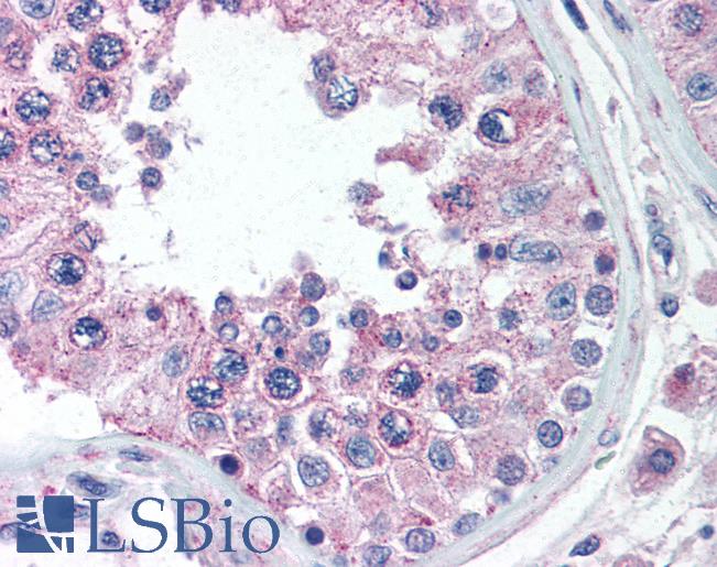 Anti-ANKRD32 antibody IHC of human testis. Immunohistochemistry of formalin-fixed, paraffin-embedded tissue after heat-induced antigen retrieval. Antibody LS-B333 concentration 5 ug/ml.