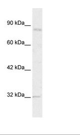 Jurkat Cell Lysate