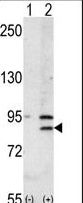 Western blot of BRD2 (arrow) using rabbit polyclonal BRD2 Antibody. 293 cell lysates (2 ug/lane) either nontransfected (Lane 1) or transiently transfected with the BRD2 gene (Lane 2) (Origene Technologies).