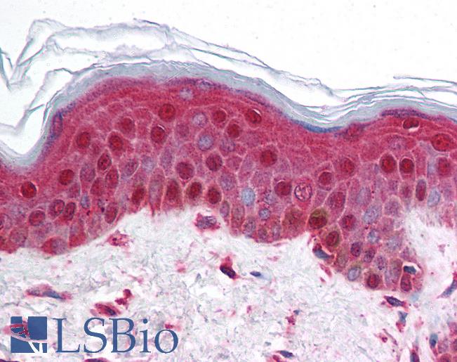 Anti-BRD2 antibody IHC of human skin. Immunohistochemistry of formalin-fixed, paraffin-embedded tissue after heat-induced antigen retrieval. Antibody LS-B923 concentration 5 ug/ml.