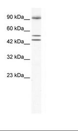 Jurkat Cell Lysate