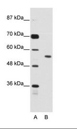 A: Marker, B: Jurkat Cell Lysate
