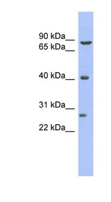 BRD3 antibody LS-C110336 Western blot of Fetal Thymus lysate.