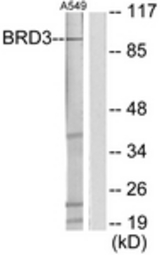 Western blot of extracts from A549 cells, using BRD3 Antibody. The lane on the right is treated with the synthesized peptide.