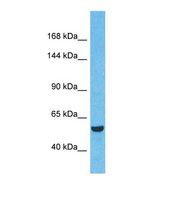 Western blot of Human Liver tumor. BRD3 antibody dilution 1.0 ug/ml.