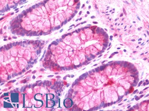 Anti-BRD3 antibody IHC staining of human colon. Immunohistochemistry of formalin-fixed, paraffin-embedded tissue after heat-induced antigen retrieval. Antibody LS-B10710 dilution 1:100.