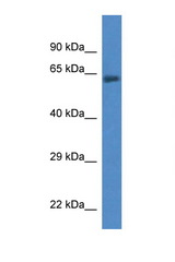 ACSF2 antibody LS-C135507 Western blot of Fetal Lung lysate. Antibody concentration 1 ug/ml.