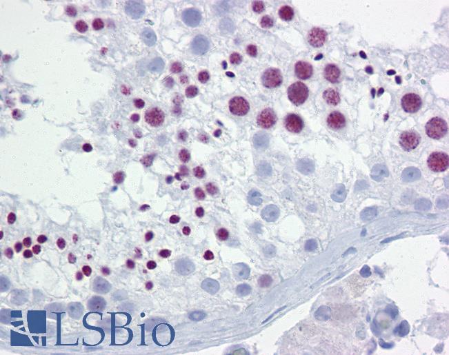 Anti-BRD3 antibody IHC of human testis. Immunohistochemistry of formalin-fixed, paraffin-embedded tissue after heat-induced antigen retrieval. Antibody LS-B6601 concentration 10 ug/ml.