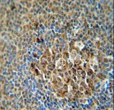 ACSF3 antibody immunohistochemistry of formalin-fixed and paraffin-embedded human tonsils tissue followed by peroxidase-conjugated secondary antibody and DAB staining.