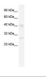 Jurkat Cell Lysate