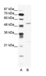 A: Marker, B: Jurkat Cell Lysate