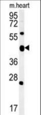 ACSF3 Antibody western blot of mouse heart tissue lysates (15 ug/lane). The ACSF3 antibody detected ACSF3 protein (arrow).