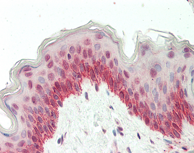 Human Skin: Formalin-Fixed, Paraffin-Embedded (FFPE)
